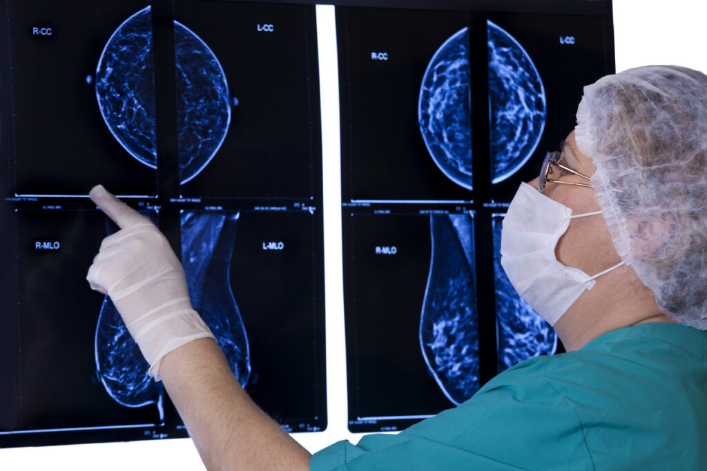 Doctor Looking MRI Scan