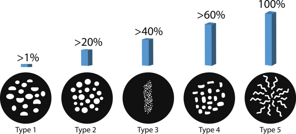 The probability of detecting breast cancer with different types of microcalcinates. Mammography. Infographics. Vector illustration on isolated background.