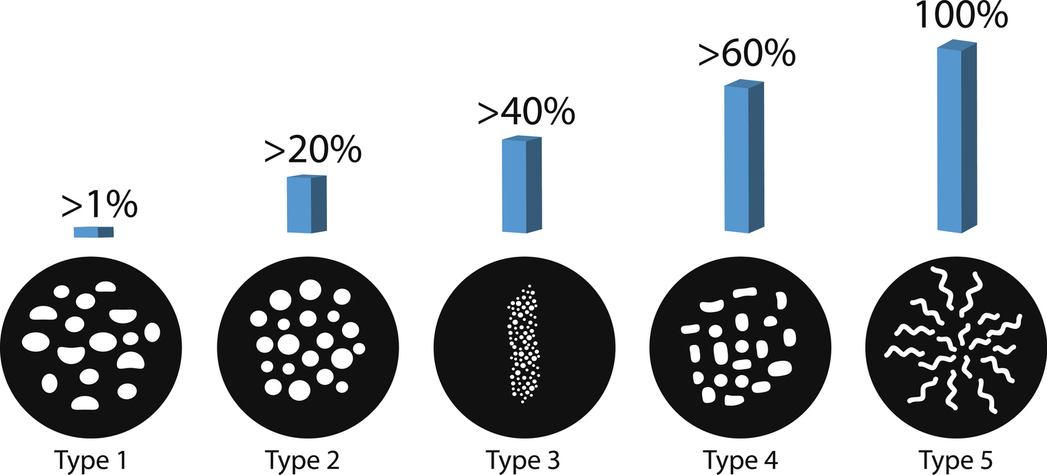 The probability of detecting breast cancer with different types of microcalcinates. Mammography. Infographics. Vector illustration on isolated background.