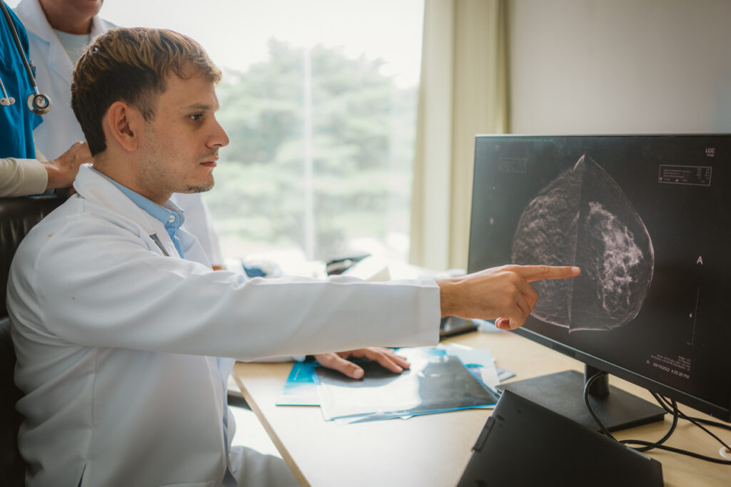 A male doctor in a white coat points at a mammogram on a computer screen while another medical professional observes in a bright office setting.