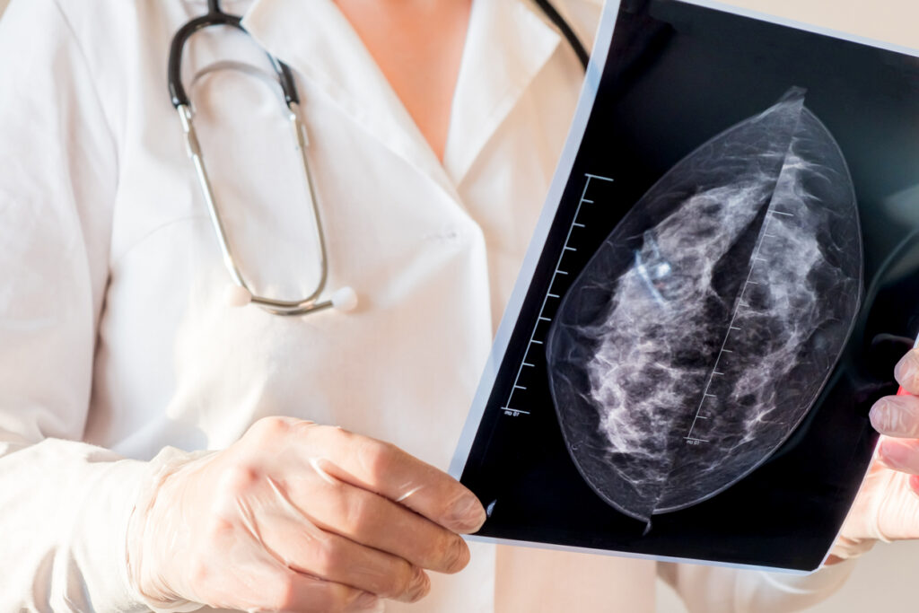Female doctor looking at mammography results on x-ray.